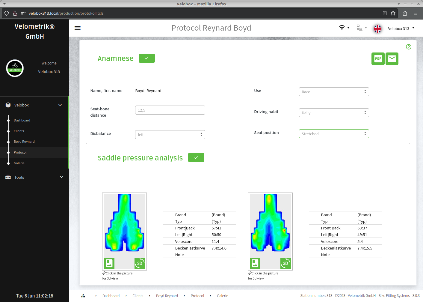 SmartCover Bike fitting Software report generator with saddle pressure mapping visualisation